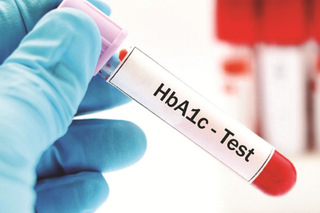 HbA1c